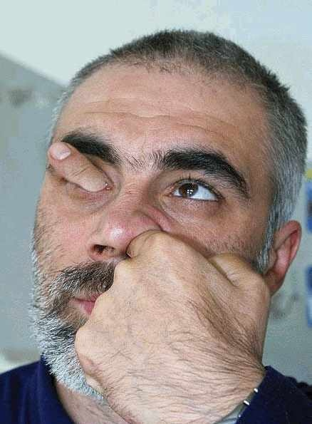 All’uragno ci pensa il dottore